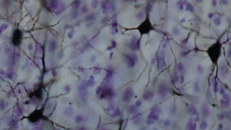 Bilim İnsanları İnsan Beyninde Yeni Bir Sinyal Keşfetti