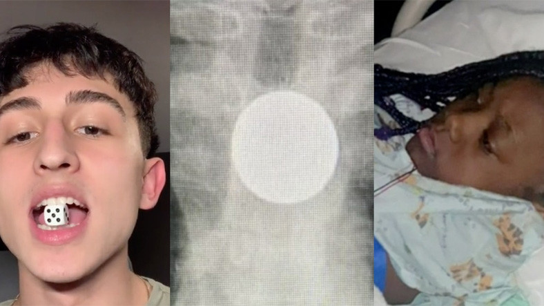 TikTok Görüntüsü, Küçük Bir Çocuğu Hastanelik Etti