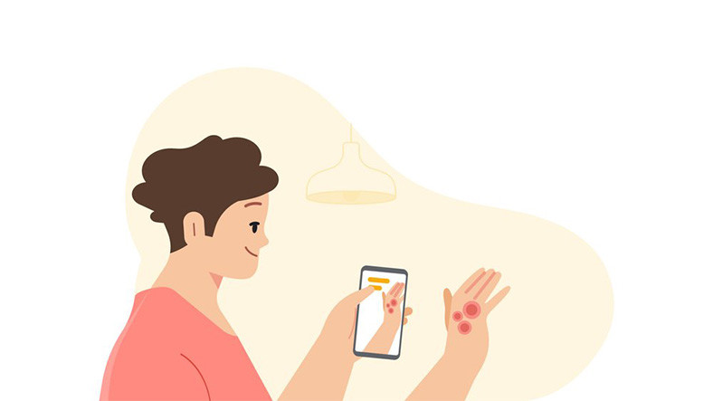 Google Dermatoloji Odaklı Yeni Uygulamasını Tanıttı