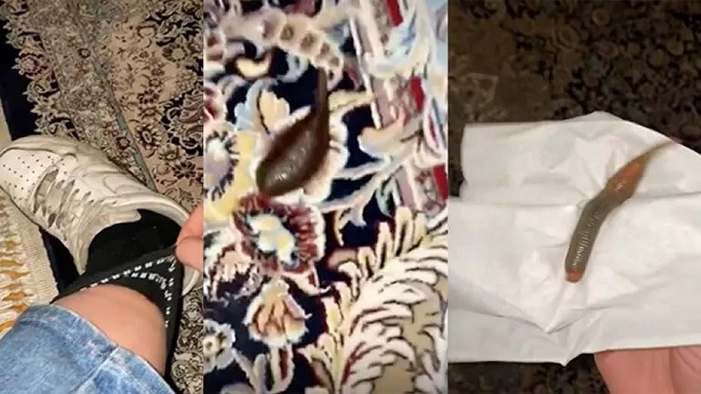 TikTok Fenomeninin Çorabından Kan Emici Sülük Çıktı