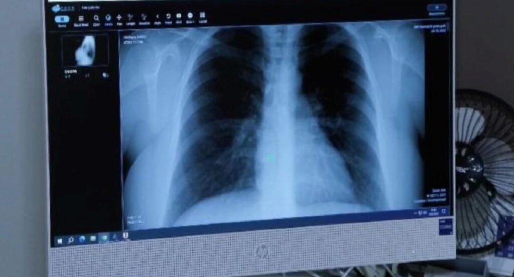 Afrika Sıcakları Kronik Akciğer ve Alerjik Hastalıkları Tetikliyor