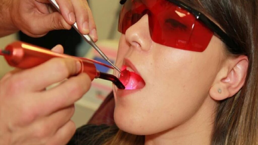 Ağız yarasına ne âlâ gelir, neden olur? Belirtileri ve tedavi yolları