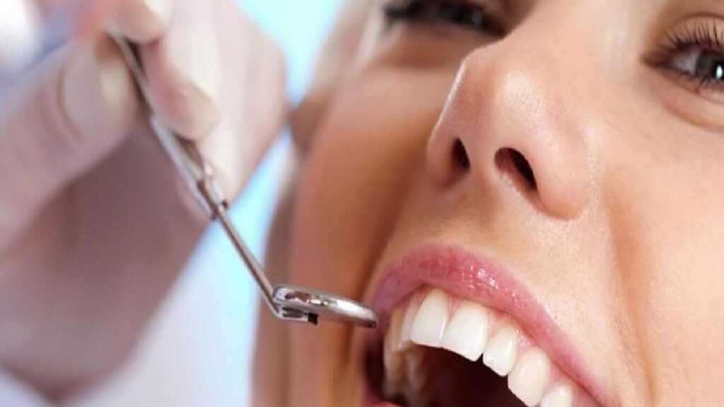 Diş taşı nedir, neden olur? Belirtileri ve tedavisi