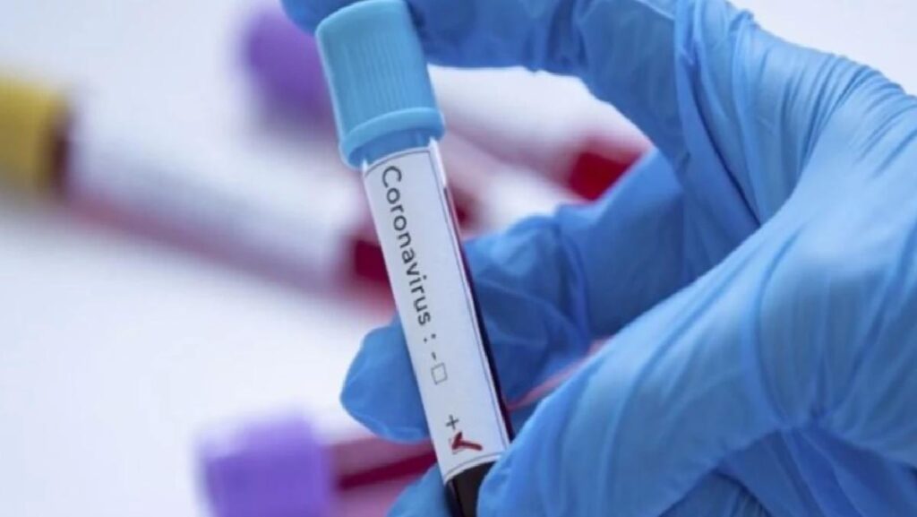 Eris nedir? Yeni Covid varyantı Eris öldürücü mü?