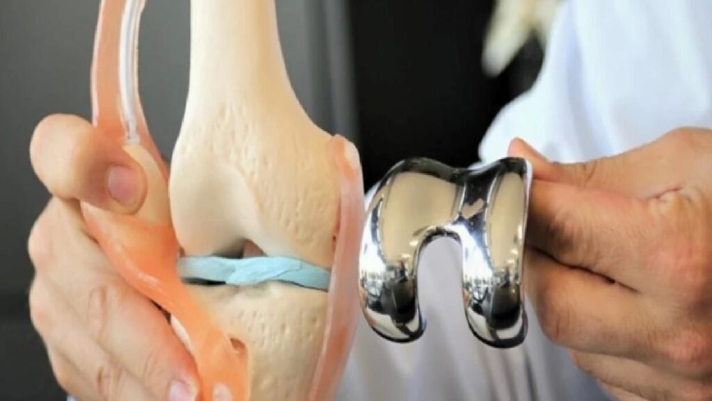 Kireçlenme nedir, neden olur? Belirtileri ve tedavi teknikleri