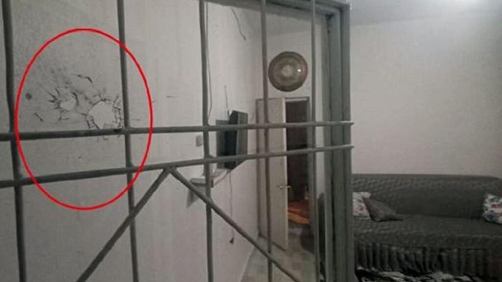 Konutunda oturan 15 yaşındaki genç kız, maganda kurşunuyla başından vurulup ağır yaralandı