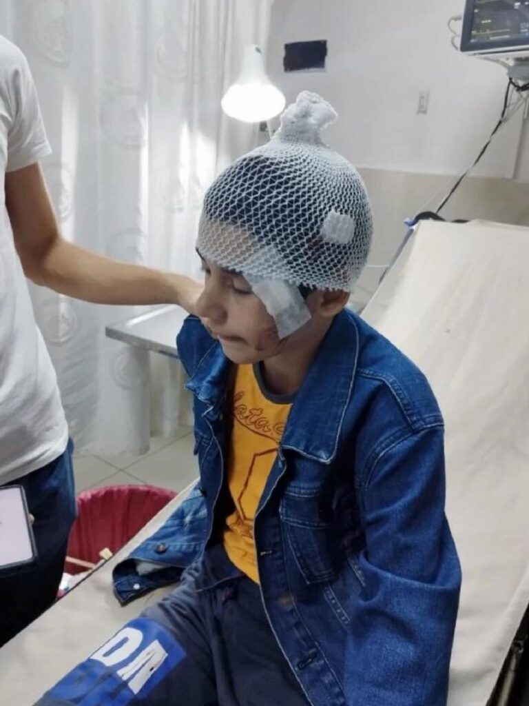 Salıncakta Oturan Çocuğa İsabet Eden Mermiyle Yaralandı