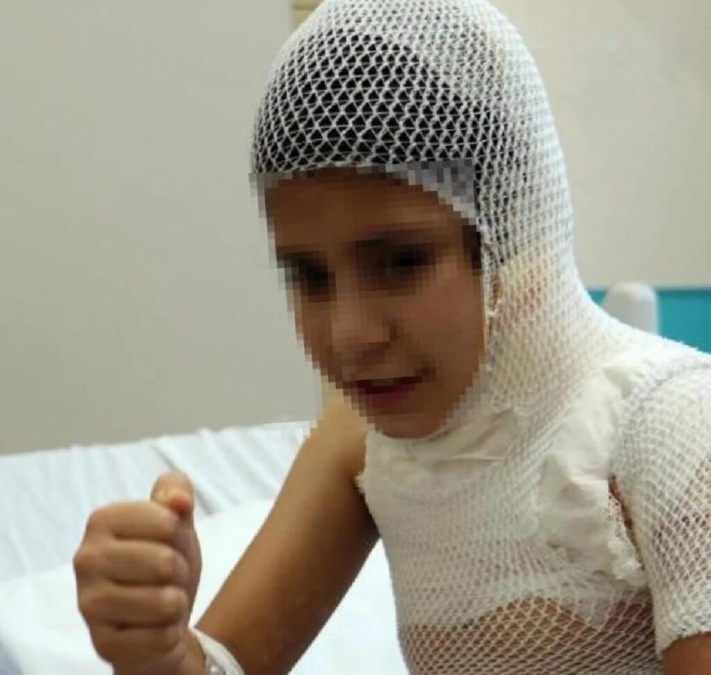 Toplumsal medya trendini deneyen çocuk ağır yaralandı