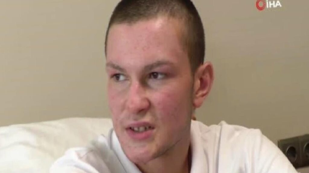 Deodorantın düğmesi basılı kaldı, çakmağı ateşledi 50’den fazla ameliyat oldu