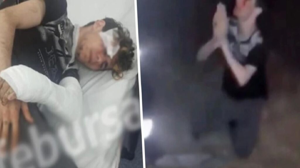 Silahlı Suriyeli küme, engelli genci öldüresiye darbetti! Bursa Valiliği’nden açıklama var