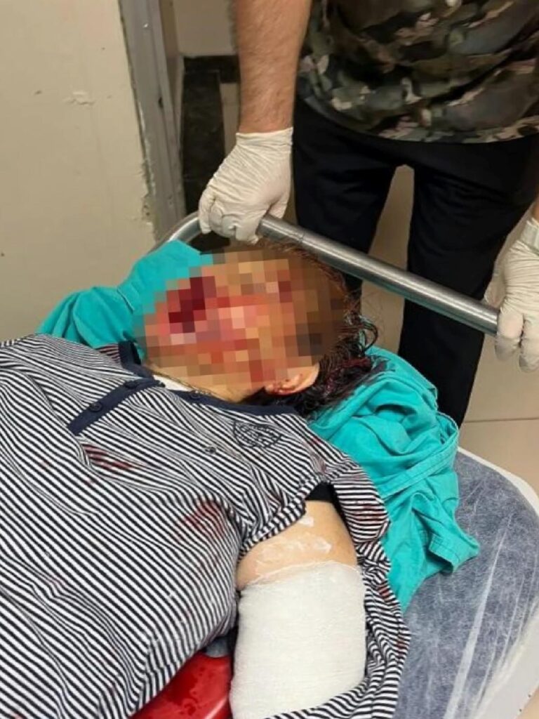 Adana’da dede ve babaanne demir kürekle darbedildi