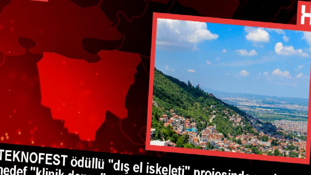 TEKNOFEST ödüllü “dış el iskeleti” projesinde yeni gaye “klinik deney”